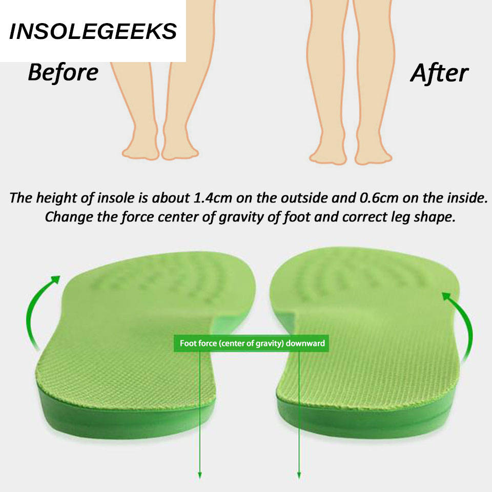 O/X-Leg Orthopedic Insoles Arch support insole corrigibil Bow Legs Valgus Varus Massaging Shoe pads Beauty Leg Feet Care